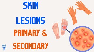 SKIN LESIONS  Primary amp Secondary [upl. by Mlawsky]