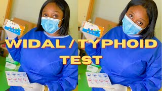 Widal test  typhoid test  Nigerian youtuber  medicallaboratoryscience widaltest typhoidfever [upl. by Stultz]