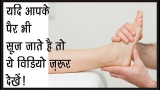 पैरों की सूजन ख़तम करने के आसान तरीका  Home Remedies For Swelling In Feet [upl. by Hamel]