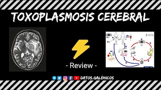 Toxoplasmosis cerebral  Review ⚡️ [upl. by Guss384]