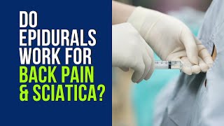 Do Epidurals Work for Back Pain and Sciatica [upl. by Odlaw]