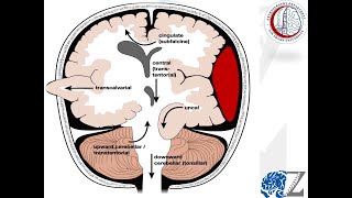 Intracranial Pressure 4 Herniation Syndromes 1 ضغط المخ [upl. by Akiria]