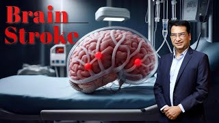 Understanding Brain Strokes Effects Symptoms amp Treatment  Expert Insights with Dr Praveen Gupta [upl. by Grunberg]