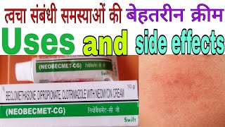 Neobecmet CG Cream Benefits and side effects in Hindi [upl. by Klump189]