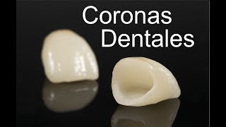 CORONAS DENTALES SOBRE IMPLANTES  PRODENT  MEDICINA EXTRAORDINARIA [upl. by Richma394]