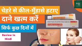 Neoclobenate Gm Cream Review in Hindi । HealthyBro। [upl. by Fachini]