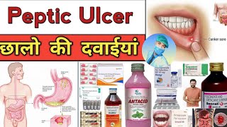 peptic ulcer। stomach ulcer। medical knowledge। medical treatment। pharmacy knowledge [upl. by Montgomery946]