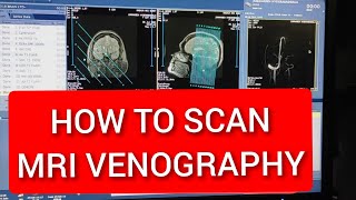 Venography MRI scan Protocol Live Demo on GE 15 Tesla  MRV Brain  Easy Technique [upl. by Kerry]