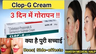 Clop G cream kaise istmal kare Jane is video me clopgcream [upl. by Navak]