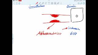 Hypoxia Vs ischemia شرح بالعربي [upl. by Dunham]