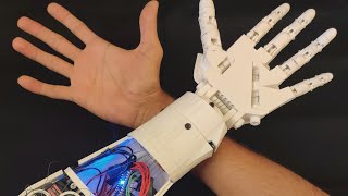 3D Printed EMG Prosthetic Hand [upl. by O'Doneven]