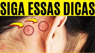 Espinhas Atrás da Orelha  As Melhores DICAS de Prevenção [upl. by Diaz644]