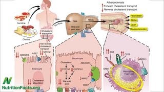 Carnitine Choline Cancer and Cholesterol The TMAO Connection [upl. by Torrell]