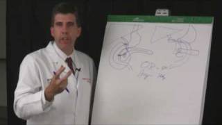 What is the Whipple Procedure [upl. by Ayram]