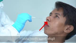 Sample Collection Oropharyngeal Swab amp Nasopharyngeal Swab [upl. by Payson553]