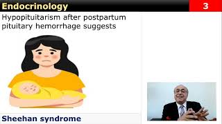 USMLE Step 2  Endocrinology 1 Flash Card Review [upl. by King]