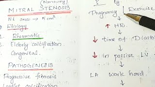 Mitral Stenosis MS Valvular Heart Disease General Medicine [upl. by Oeflein]