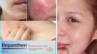 BEPANTHEN CREAM for DAMAGED amp IRRITATED SKIN [upl. by Ahseinat508]