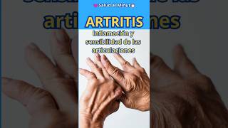 ARTRITIS  inflamacion y sensibilidad de las articulaciones [upl. by Rahsab342]