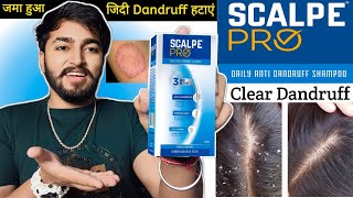 Scalpe Pro Anti Dandruff Shampoo Review  Daily Anti Dandruff Shampoo [upl. by Dareece]