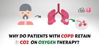 Oxygen Induced CO2 Narcosis in COPD Patients [upl. by Nneb302]