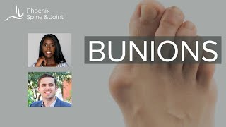 How long after bunion correction does it take to walk without pain [upl. by Airoled]