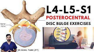 L4L5S1 posterocentral disc bulge exercises  L4L5 and L5S1 central disc bulge treatment in hindi [upl. by Bilek]