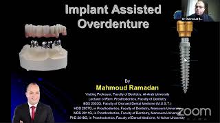 Implant Assisted Overdenture [upl. by Enneillij]