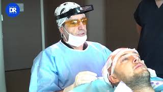 Kompletter Ablauf der Haartransplantation  Dr Hamid Aydin [upl. by Vorfeld]