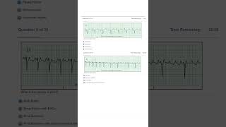 Relias Dysrhythmia Basic Test 35 Questions and Answers 2023 Basic A Dysrhythmia [upl. by Lewes]