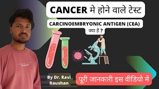 Carcinoembryonic antigen CEA क्या है [upl. by Adlih]