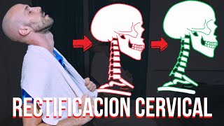 El MEJOR ejercicio para la RECTIFICACION CERVICAL [upl. by Gesner]