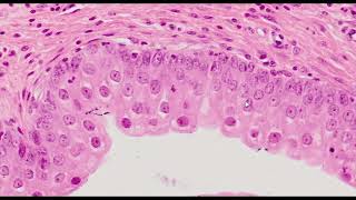 Transitional Epithelium HampE Staining  PUMS Histology Slides Review Series [upl. by Mossberg634]