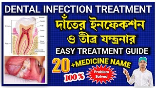 Dental infection treatment in banglaTooth infection treatmentTooth infection medicinedental [upl. by Gross]