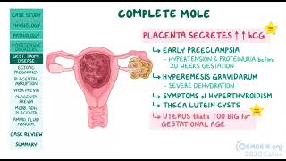 OSMOSIS Ectopic pregnancy Gestational Hypertension placental abruptions Troph disease 🔥🔥 [upl. by Jacy]