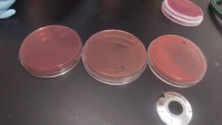 Macconkey Agar [upl. by Juan]