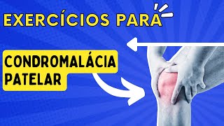 EXERCÍCIOS PARA CONDROMALÁCIA PATELAR [upl. by Lorianna816]