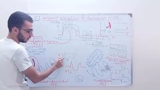 شرح آلية تزحل الوصلة الشدفة ST للأعلى وللأسفل ST Elevation amp ST depression [upl. by Olshausen932]