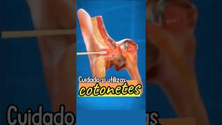 Cuidado‼️ salud cuidados oidos sabiasque tips shorts cuidadopersonal oídossanos [upl. by Fougere]