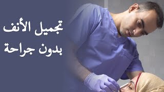 تجميل الأنف بالفيلر  د محمد الناظر [upl. by Sterling]