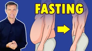 Intermittent Fasting for SERIOUS Weight Loss  Dr Berg [upl. by Larine]