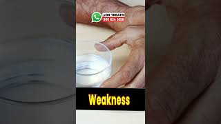 Debility  Physical Weakness  Homeopathic Medicine For Weakness [upl. by Arrac]