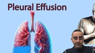 Water on the Lungs Understanding Pleural Effusion Causes and Symptoms [upl. by Denten808]