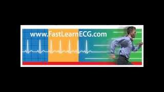 12lead ECGEKG Differentiating between atrial and ventricular arrhythmias [upl. by Rhody]