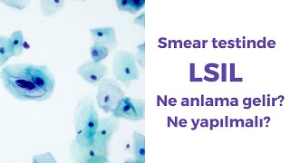 Smear testinde LSIL ne anlama gelir Ne yapılmalı [upl. by Demb]