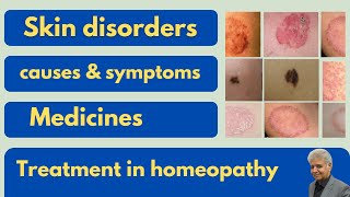 Skin disorders and homeopathy Dr Ali Muhammad [upl. by Pozzy]