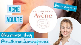 Live Dermato Drey et Avène  acné de ladulte boutons quotimperfectionsquot [upl. by Tnafni]