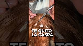 TE QUITO LA CASPA asmr shorts asmrvideo comedia [upl. by Lemej374]