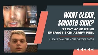 WANT CLEAR SMOOTH SKIN TREAT ACNE USING EMERAGE SKIN AERIFY PEEL  ALEXIS TAYLOR x DR JASON EMER [upl. by Kyle]