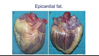 CARDIOVASCULAR PART TWO THE HEART episode 2 [upl. by Folly]